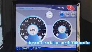 Rimozione verticale del tatuaggio di ringiovanimento della pelle della macchina del laser di picosecondo del ND Yag