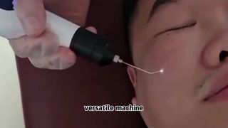 Máquina fria e morna da fusão do plasma para a pele que aperta a remoção do enrugamento
